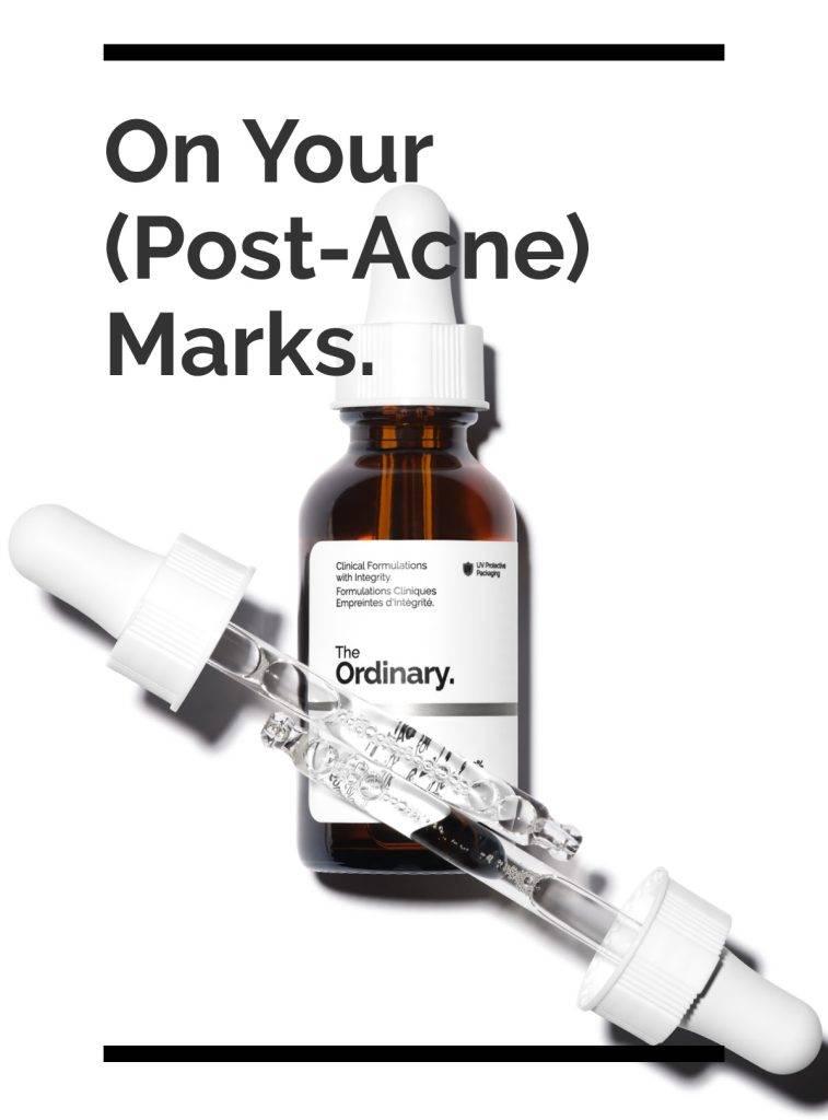 The Ordinary Aloe 2% + NAG 2%